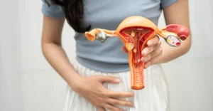 Frau hält sich mit einer Hand den Unterbauch und zeigt mit der anderen ein anatomisches Modell von Gebärmutter, Eierstöcken und Eileitern – Symbolbild für gynäkologische Beschwerden, Menstruationsbeschwerden und Frauengesundheit